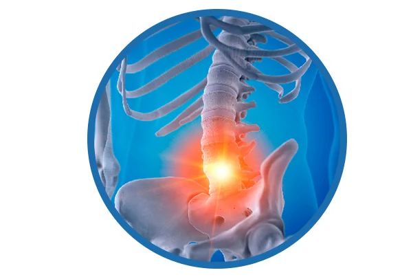 Ankylosing Spondylitis