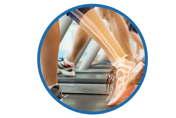Bone Health