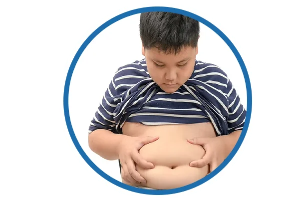 Childhood Obesity