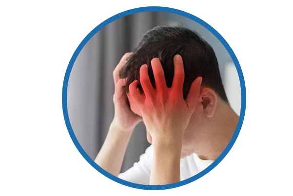 Migraine